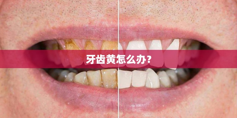 牙齿黄怎么办？