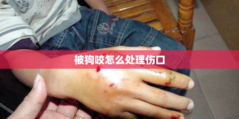 被狗咬怎么处理伤口 被狗咬怎么处理伤口