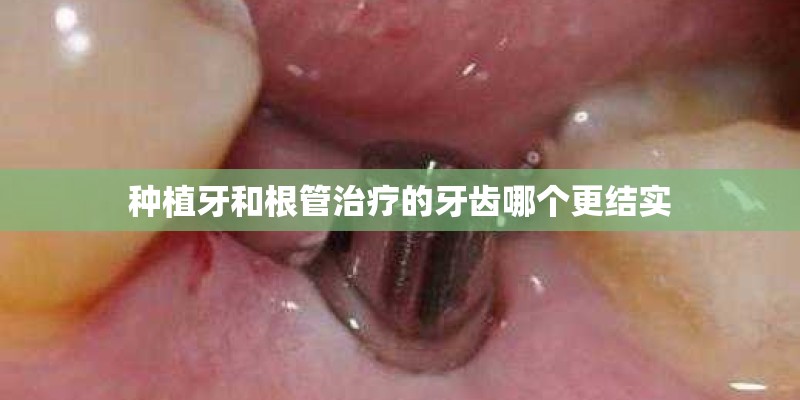 种植牙和根管治疗的牙齿哪个更结实