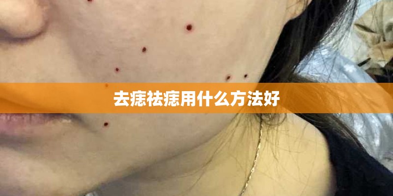去痣祛痣用什么方法好