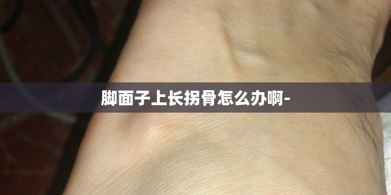 脚面子上长拐骨怎么办啊-
