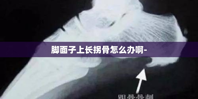 脚面子上长拐骨怎么办啊-