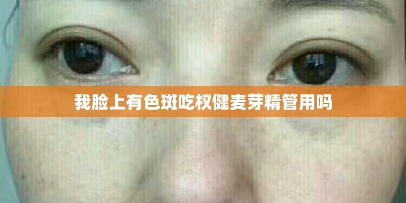 我脸上有色斑吃权健麦芽精管用吗 我脸上有色斑吃权健麦芽精管用吗