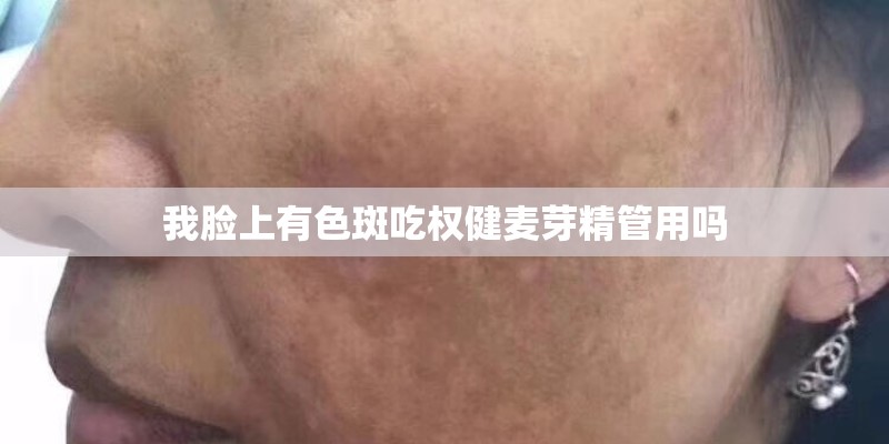 我脸上有色斑吃权健麦芽精管用吗 我脸上有色斑吃权健麦芽精管用吗