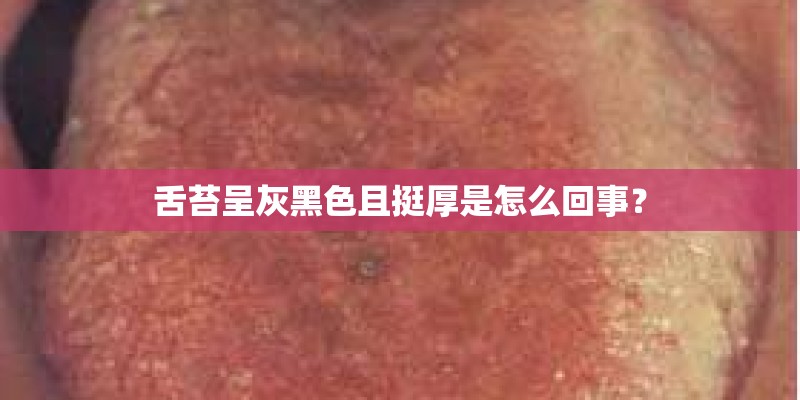 舌苔呈灰黑色且挺厚是怎么回事？