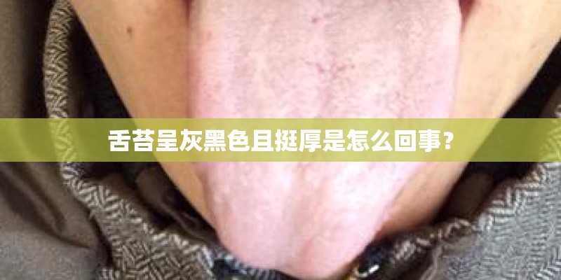 舌苔呈灰黑色且挺厚是怎么回事？